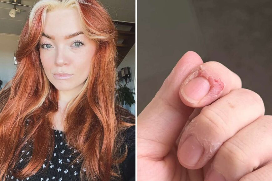 Emilie, foto privat, fra VG